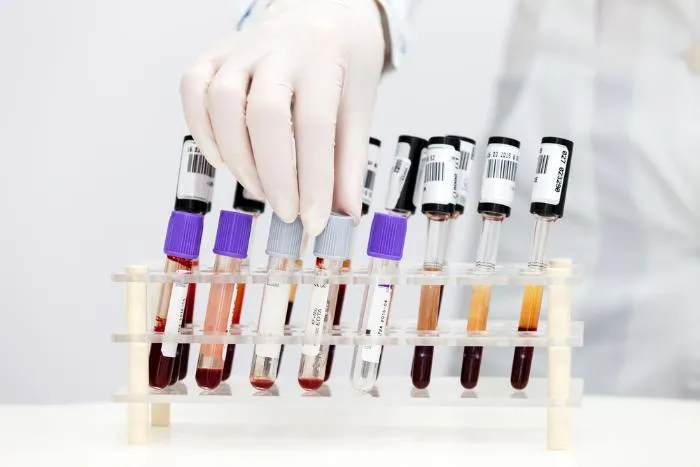 50.0.H122.900 Антифосфолипидный синдром (АФС)
