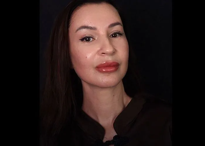 Деликатный фейслифтинг от DR. Сотникова @dr.sotnikov