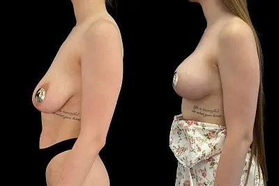 #