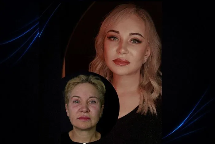 О методе