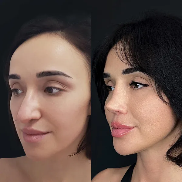 Пластическая хирургия