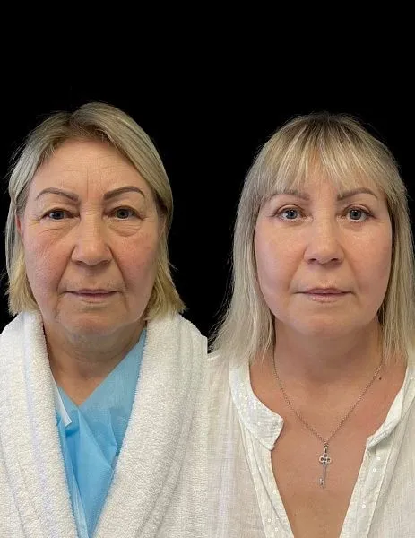 #
