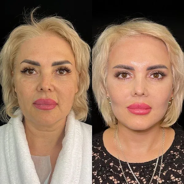 #