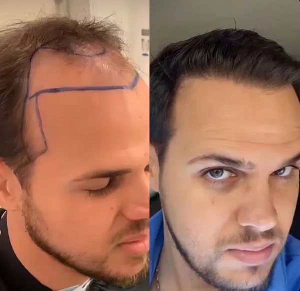 #